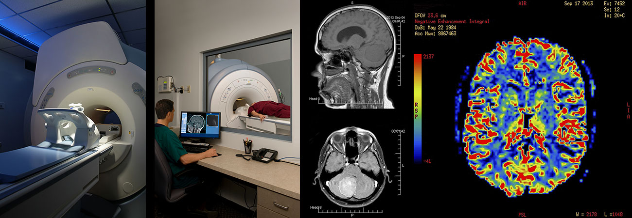 Мрт делают во время месячных. Магниторезонансная томография (мрт). Снимки томограммы головного мозга. Ядерно-магнитно-резонансная томография мозга магнитно-резонансная. Кт рентген головного мозга.